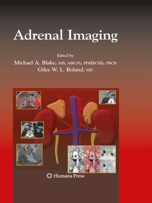 cover image of Adrenal Imaging